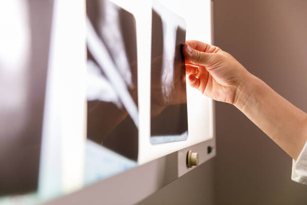 Close up shot of unrecognizable female radiologist arranging scans on x-ray lightbox to review them.