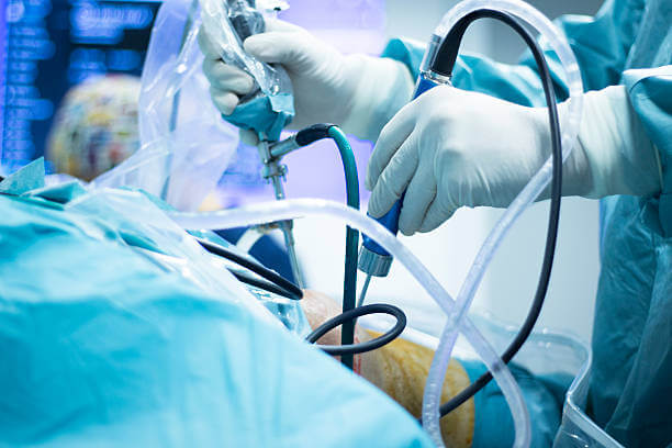 Knee arthroscopy orthopedic surgery operation in hospital operating room photo showing surgeon with arthroscopy camera and probe.
