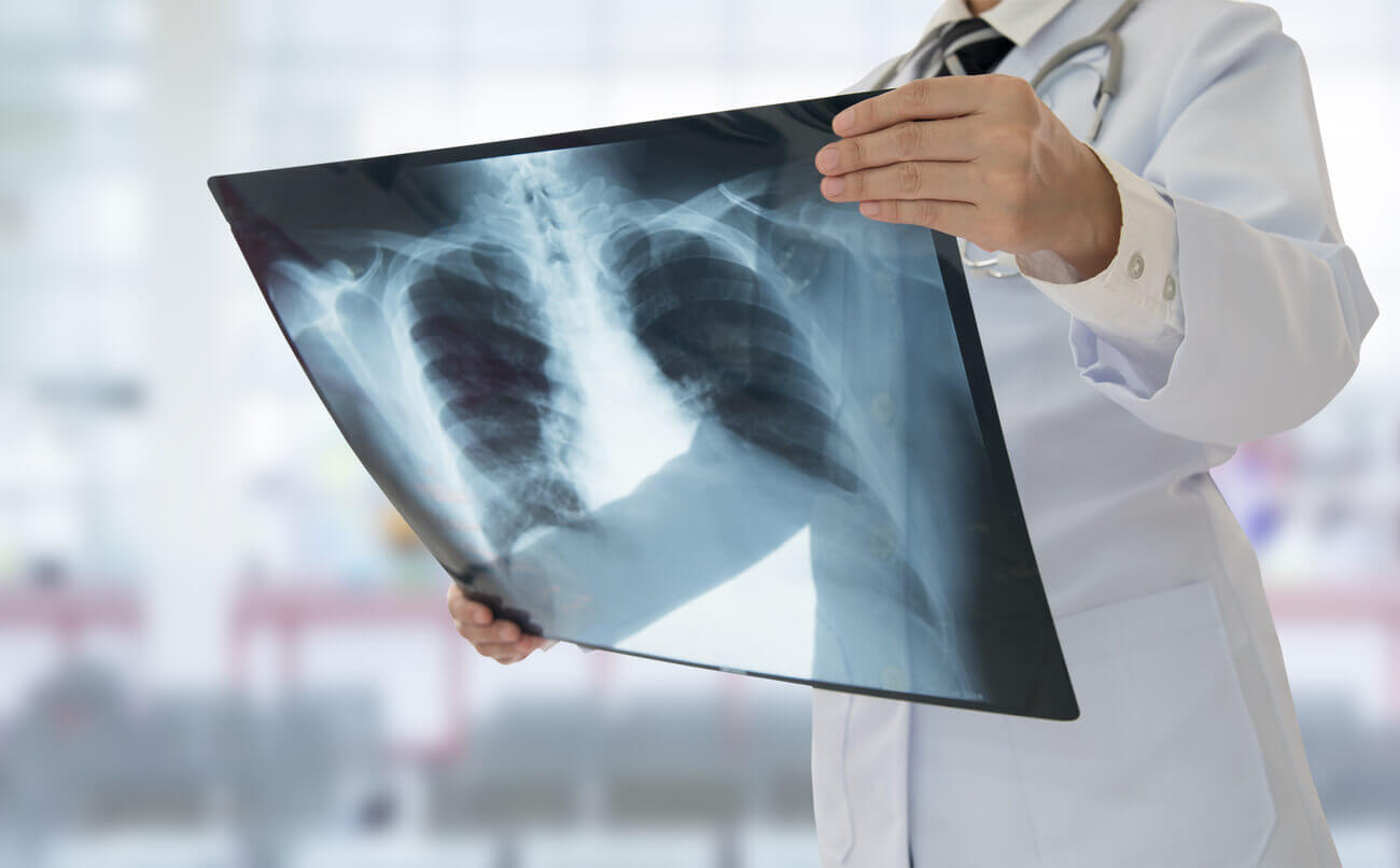 Doctor x-ray