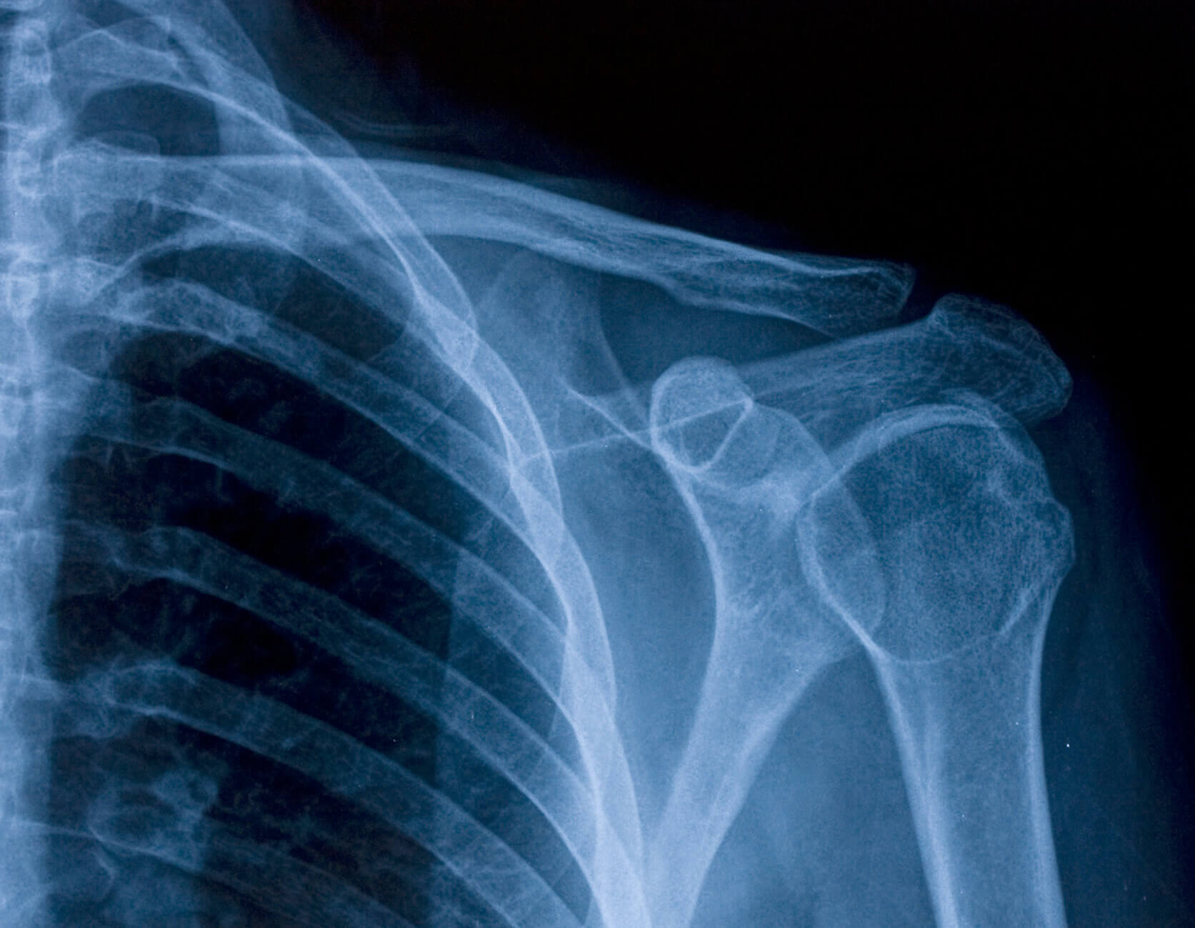 X-rays in Cancer Diagnosis - Childhood Injuries - Patient Care Now Urgent Care - Fairless Hills PA